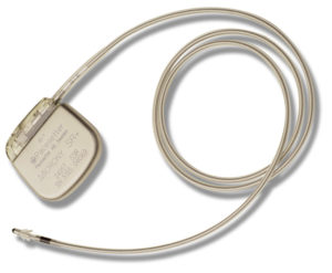 exemple de tpe s le pacemaker